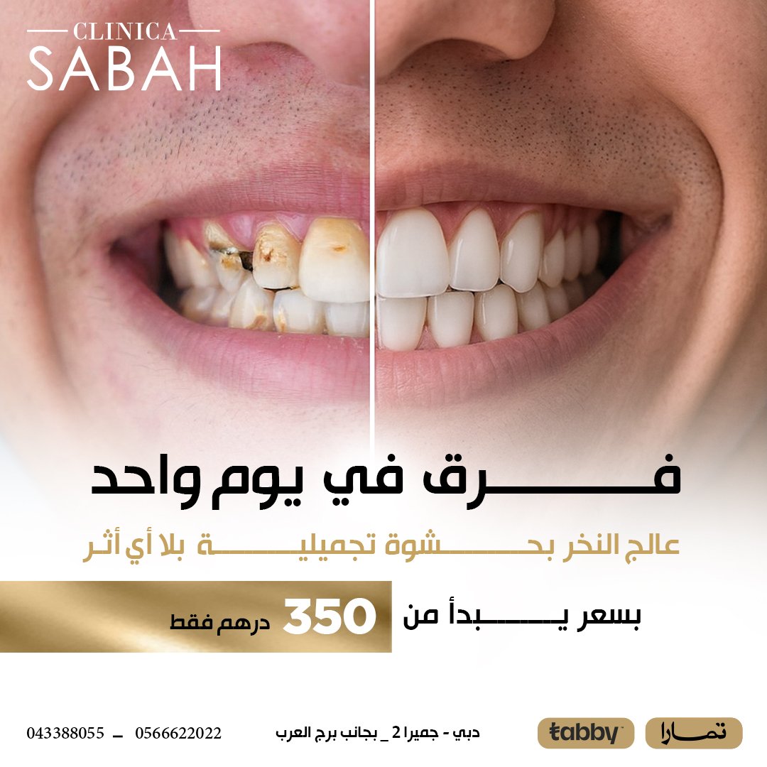 Dental Fillings Post