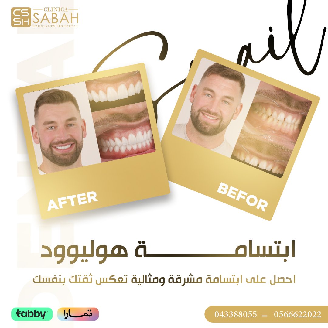 Smile Design Promotion